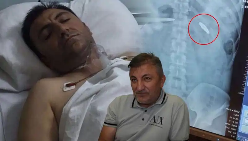 15 Temmuz'dan Sonra Hayatta Kalmanın Bedeli: Kurşunla Dolu Bir Geçmiş