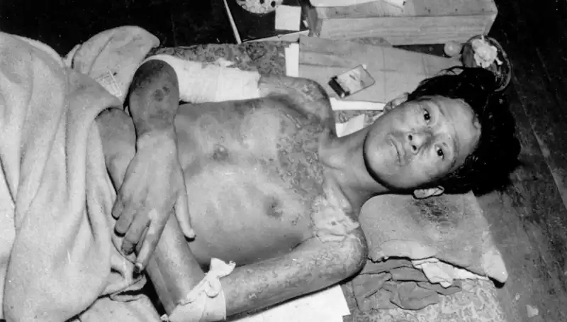 80 Yıl Sonra Nagasaki’den Gelen Uyarı: Nükleer Felaket Tehdidi!